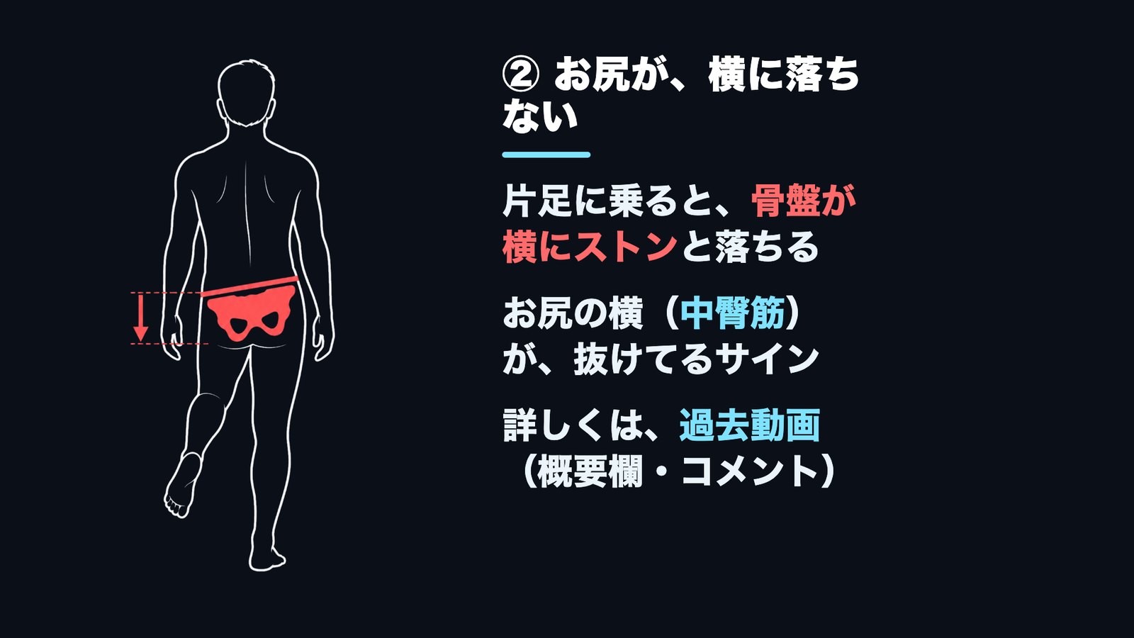 片足立ちで骨盤が横に落ちる＝お尻の横（中臀筋）が抜けているサインの図