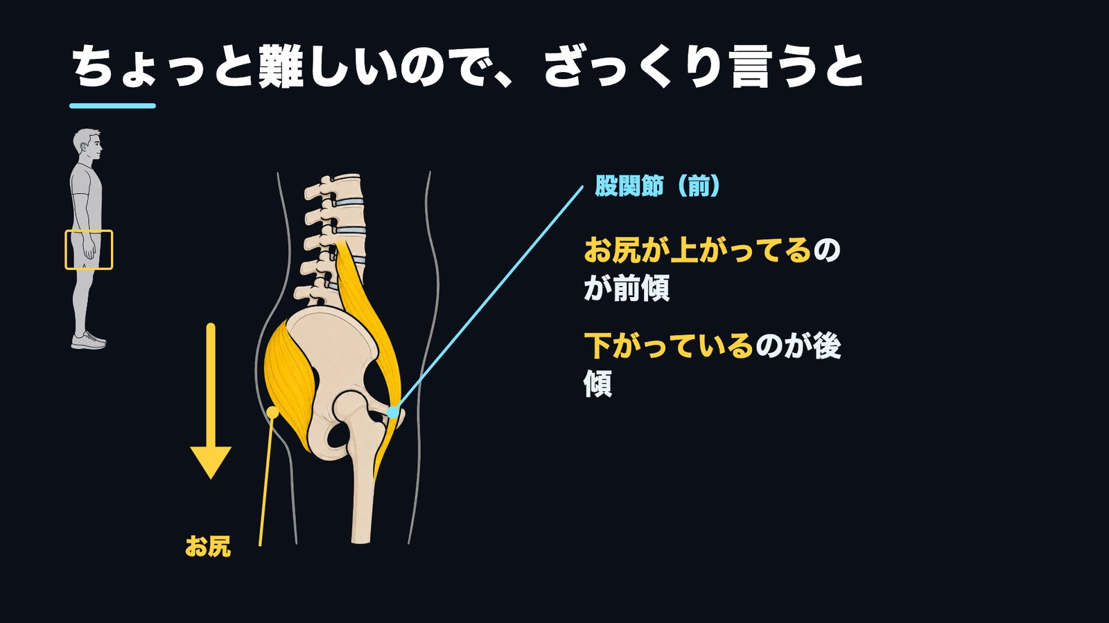 反り腰 骨盤の前傾と後傾 お尻が上がる下がる 図解