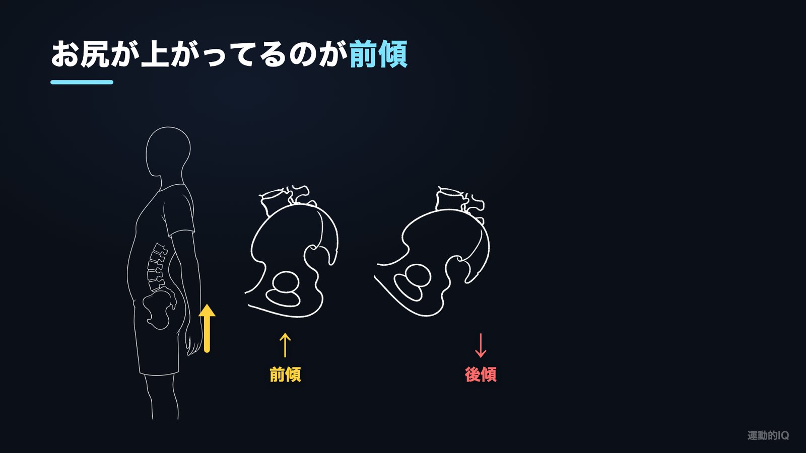 スクワットの骨盤 お尻が上がっているのが前傾 下がっているのが後傾の図